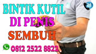 Cara Menghilangkan Bintik Bintik Kutil Di Kelamin Pria