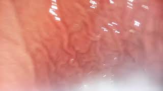 Reporting There Is Air In The Stomach, Allows For Survival