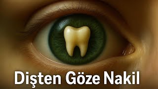 Disten Göze Nakil Pitv
