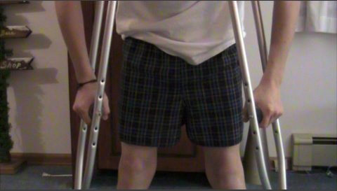 Pantless Knights Video Contest- Damn Crutches