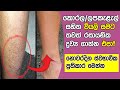 Dry skin treatment at home sinhala - How to maintain a dry skin