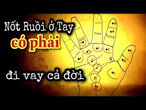 Xem Bói NỐT RUỒI Ở Tay. Nốt Ruồi Ở Tay Có Phải Đi Vay Cả Đời ?