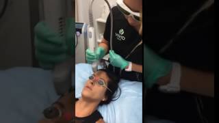 Vivid Face Laser Facial