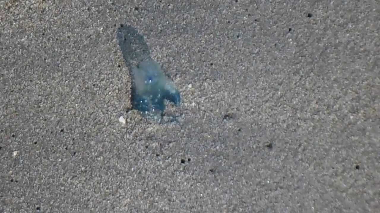 Los dolores en los riñones pueden ser a la hernia