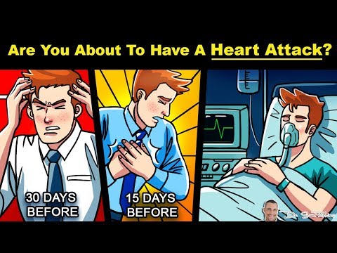 💓Are You About to Have A Heart Attack? - 30 Day Warning Signs - by Dr Sam Robbins