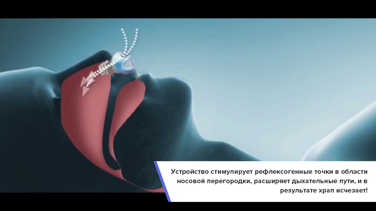 Как избавиться от храпа у мужчин в домашних условиях 713