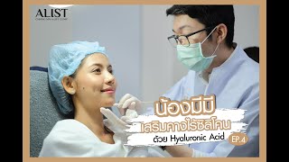 เสริมคางแบบไม่ต้องผ่าตัด ด้วย Hyaluronic Acid สกัดจากธรรมชาติ