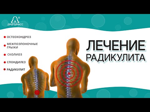 Отнялась поясница как лечить Отнялась поясница как лечить