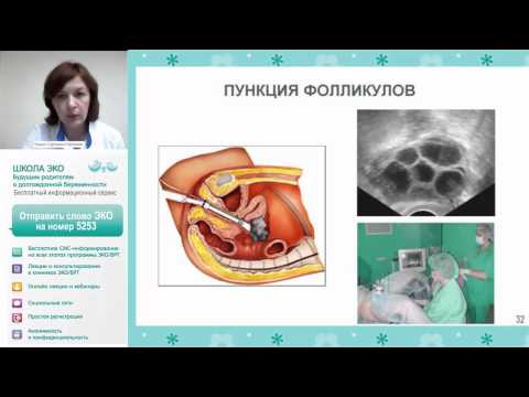 Как сделать эко икси по омс Как сделать эко икси по омс