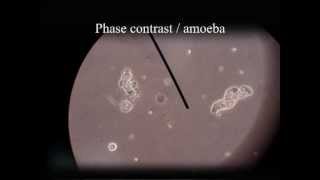 Darkfield & Phase contrast video