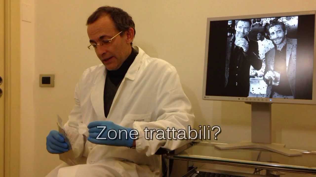 Cicoria e thrombophlebitis