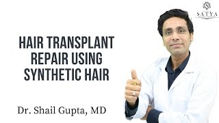 Hair Transplant Repair with Synthetic Hair Implant