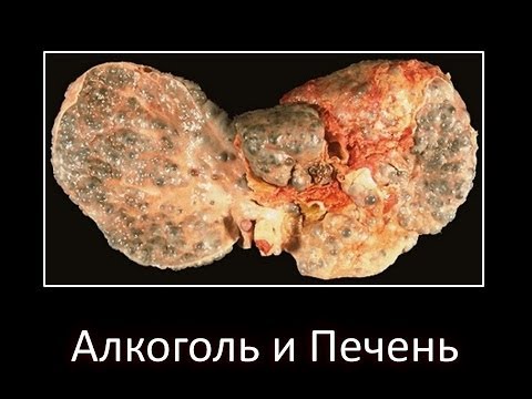 фото последствия алкоголя онлайн фото последствия алкоголя