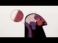 What causes headaches? - Dan Kwartler