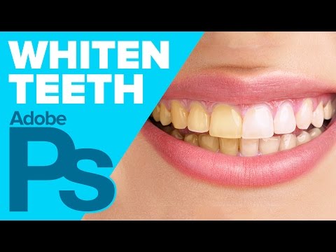 Photoshop: White Teeth in Photoshop (HD)
