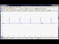 PicoScope 6: Using the Logic Trigger