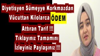 Diyetisyen Sümeyye Korkmazdan Vücuttan Kilolarca Ödem Attıran Tarif