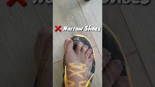 Do Your Feet Fit In Your Shoe?