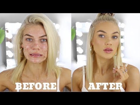 EVERYDAY MAKEUP FOR ACNE PRONE SKIN + Personal Life Update - YouTube