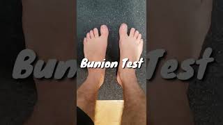 Do You Have Bunions??? Use This Test To Find Out.