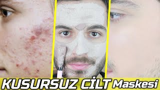 Bu Maskeyi Her Gün 1 Kere Yap Ve Kusursuz Gözeneksiz Cam Gibi Cilt Senin Olsun Güzellik Bakım