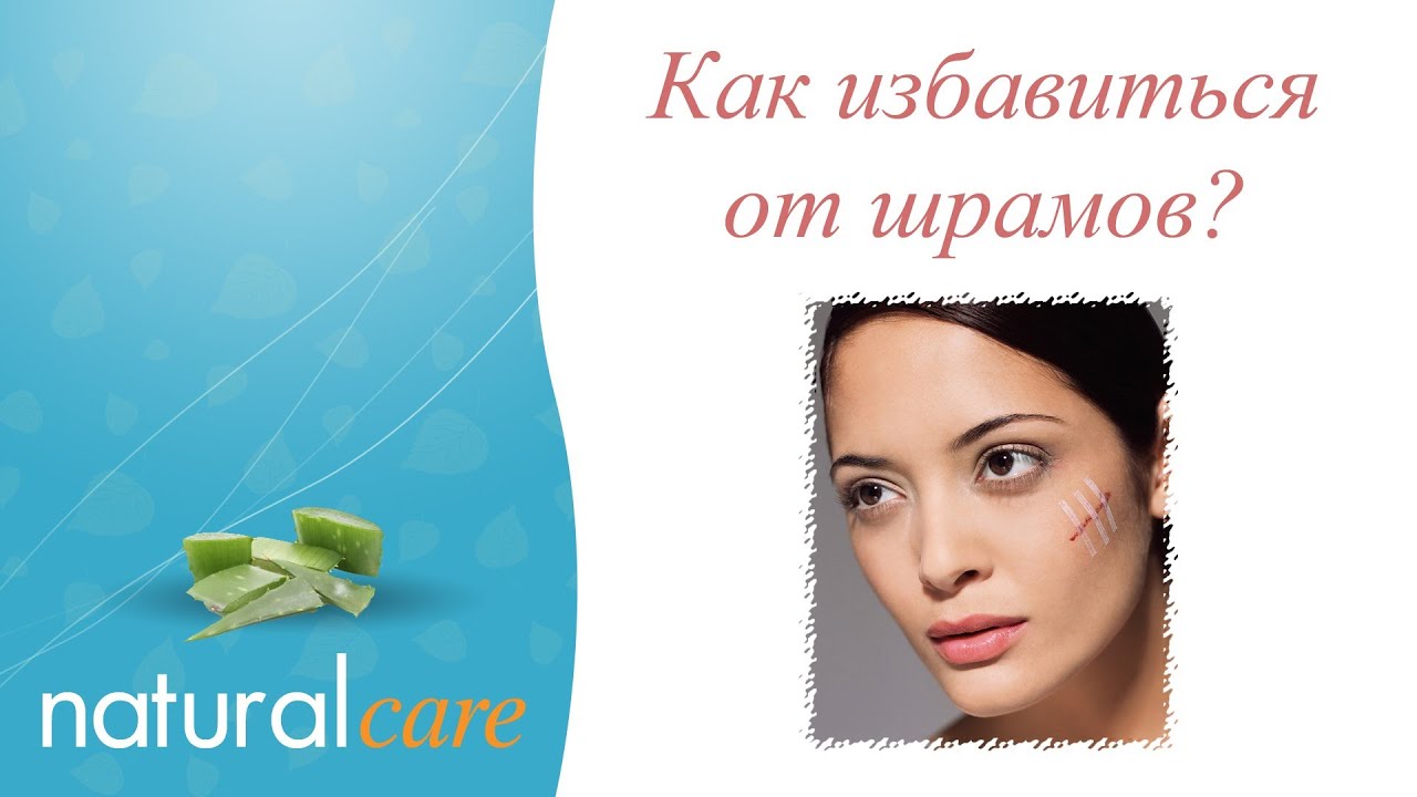 Как избавиться от шрамы домашних условиях Как избавиться от шрамы домашних условиях