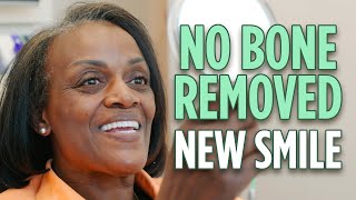 No Bone Removal! 3 on 6™ Dental Implant Smile Restoration Benefits over All on 4