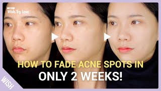 3 Secrets To Remove Acne Pigmentation & Brighten Skin Complexion In The Most Effective & Fast Way