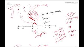 Hypertrophic obstructive cardiomyopathy (HOCM) - Dr Jamal USMLE