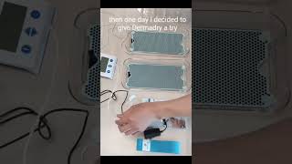 Dermadrys Anti-Sweat Device For Hyperhidrosis We Got You