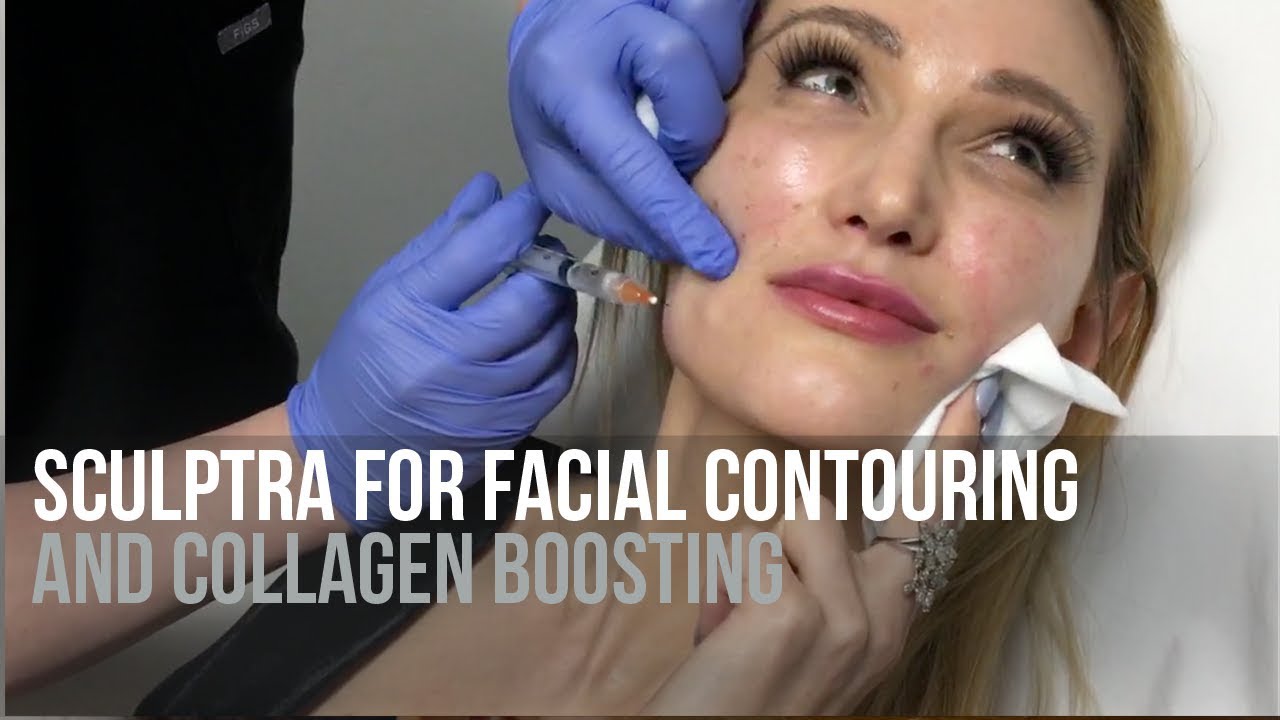 Facial sculpting surgery