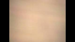 Ullswater Foxhounds Retrieving Patterdale Terrier From Below Ground Pt2