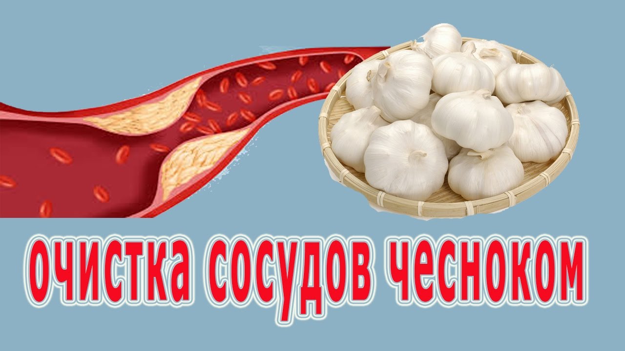 Чистка сосудов народными средствами в домашних 16 Чистка сосудов народными средствами в домашних 57