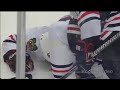 Andrew Shaw gets a puck in the face . June 24, 2013