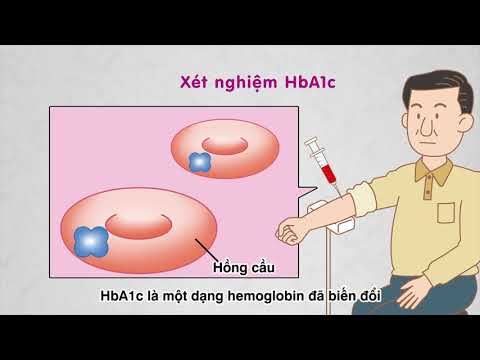 【43】Các chỉ số cần lưu ý Chỉ số HbA1c
