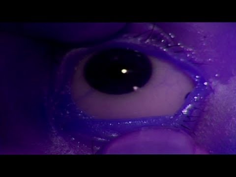 Prophet Of Eosphorus Video