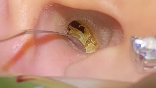 Asmr Ear Clean Deep Cleaning With Real Japanese Style