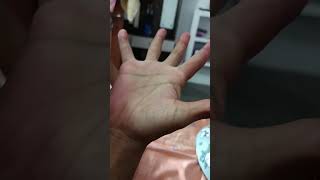 I Have 4 Fingers
