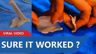 This Is A Trick To Easily And Quickly Remove The Gum Stuck To Your Pants Using Only Ice Cubes