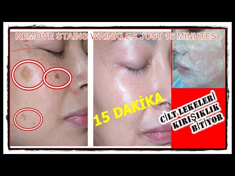 BUNU SÜREN 15 DAKİKA SONRA GÖZLERİNE İNANAMIYOR MAYA MASKESİ İLE LEKE -KIRIŞIKLIK YOK OLUYOR