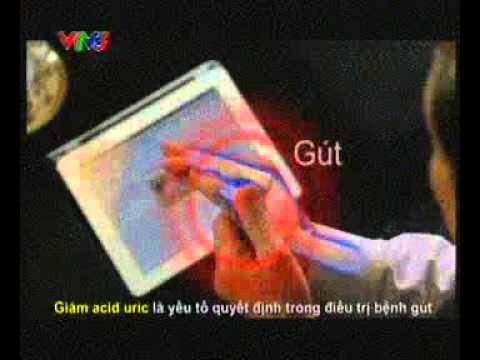 10 01 12 HOANG TIEN DAN Gout Treatment HOANG TIEN DAN 20s TVC Archives