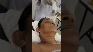 Hyper Pigmentation Treatment With Miracles Salon Shani Peiris