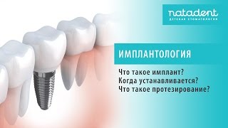 Что такое протезирование зубов у детей Что такое протезирование зубов у детей