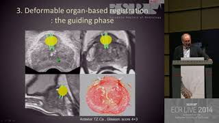 Gu - Mage Guided Prostate Biopsies A Paradigm Shift 5