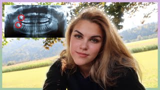 Zdej Mam Mir Do Konc Življenja