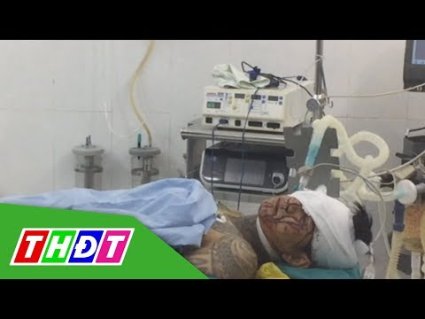 Hai nhóm giang hồ chém nhau, 3 người bị thương | THDT