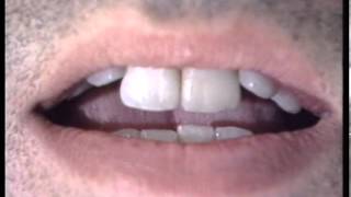 Watch Robyn Hitchcock Surgery video