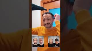 Clinica Murat Makasci - 10.000 Grafts Fue - 2 Chirurgie