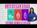 Full LABIAPLASTY SURGERY with Dr. Rejuvenation