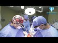 Cirugía de Bypass Coronario sin utilizar bomba de circulación extracorpórea. HCSF